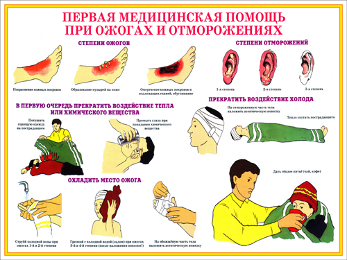 Первая мед помощь при ожогах презентация